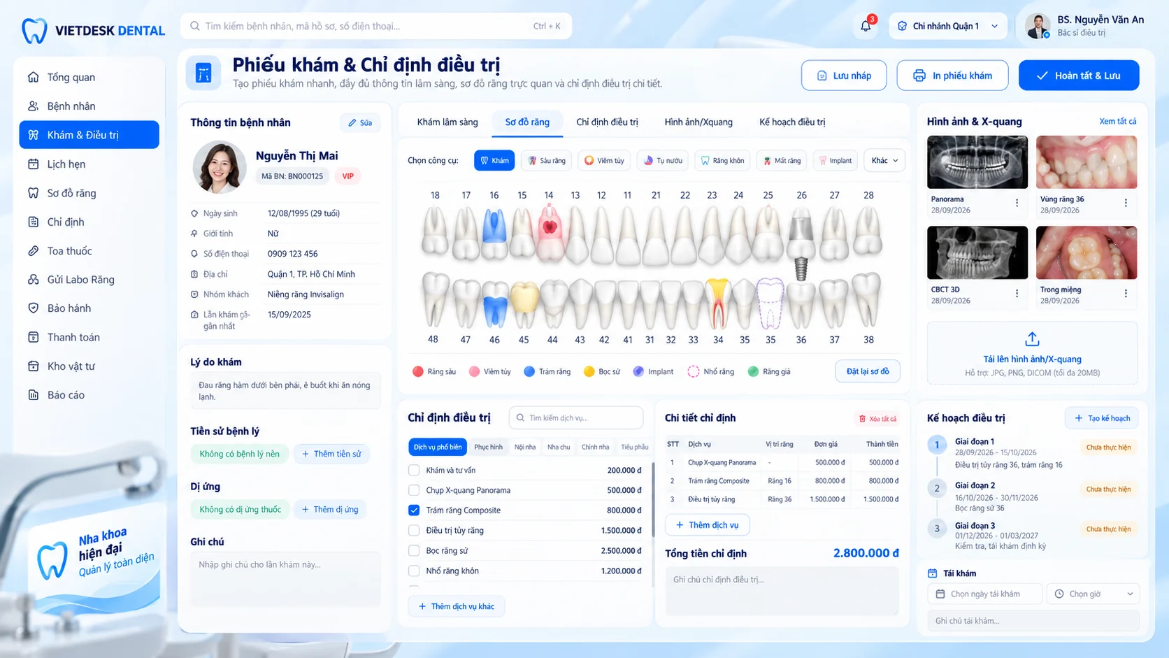 Minh họa tính năng Sơ đồ răng & chỉ định của VIETDESK DENTAL